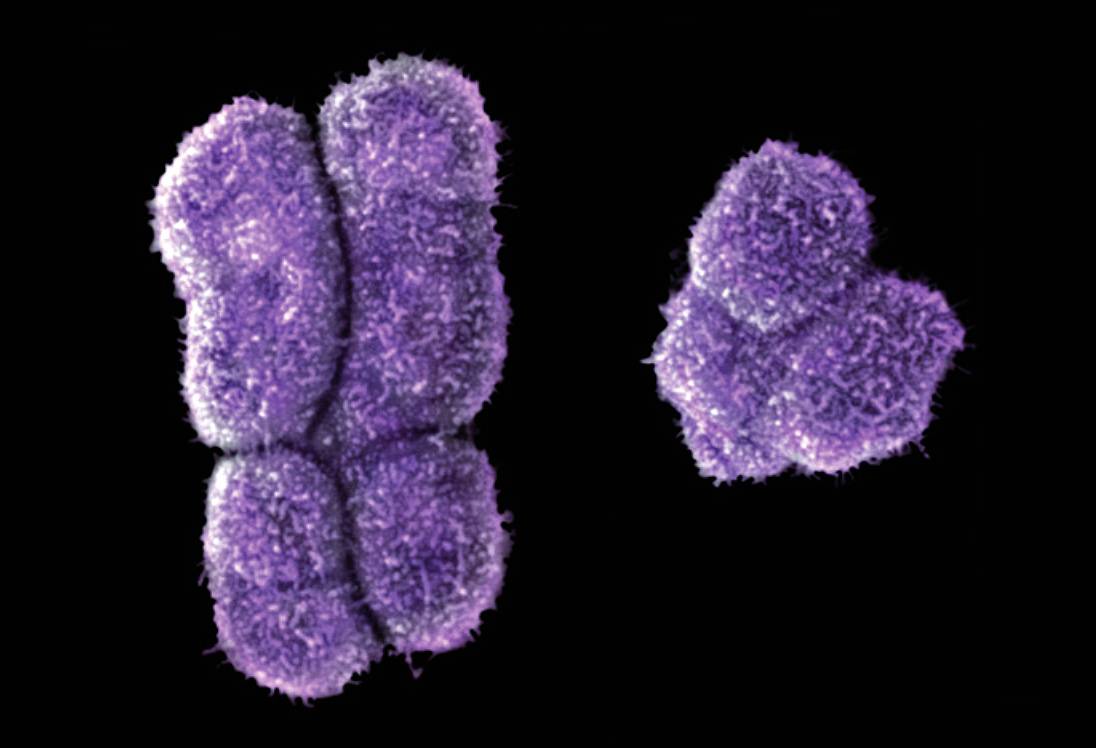 El cromosoma Y humano (derecha) es mucho más pequeño que el cromosoma X (izquierda). / POWER AND SYRED/SPL. 