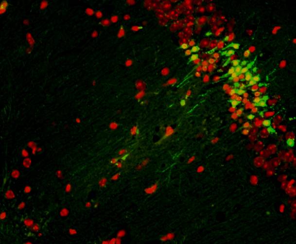  La inyección en el cerebro de un péptido que imita parte de la función de MARCKS fue suficiente para mejorar el aprendizaje de los ratones viejos. / CSIC