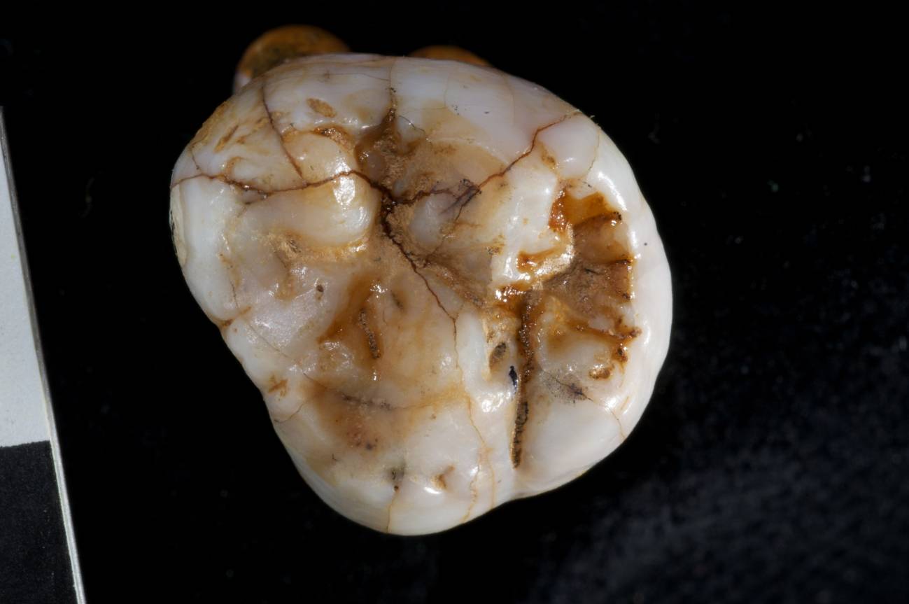 Uno de los molares descubiertos en la cueva Denisova (Siberia) en 2010. Imagen: Instituto Max Planck de Antropología Evolutiva.  