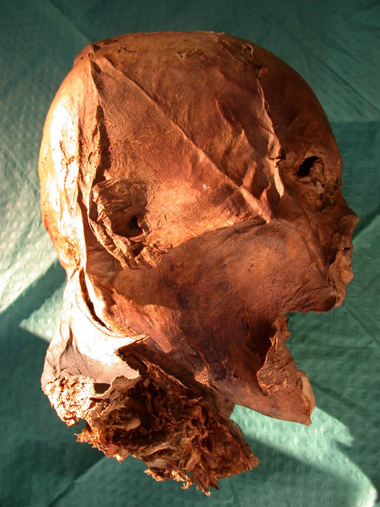 Cabeza momificada de Enrique IV. Imagen: Philippe Charlier 