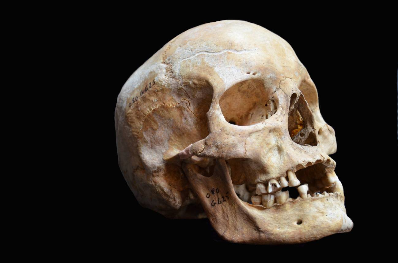 En la imagen, uno de los cráneos de la Edad Media analizados. / Ben Krause-Kyora