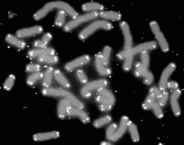 Cromosomas humanos rematados por telómeros (en blanco). Imagen: Wikipedia 