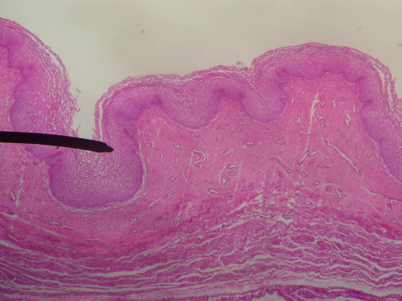 Mucosa vaginal al microscopio. Imagen: Wikipedia 