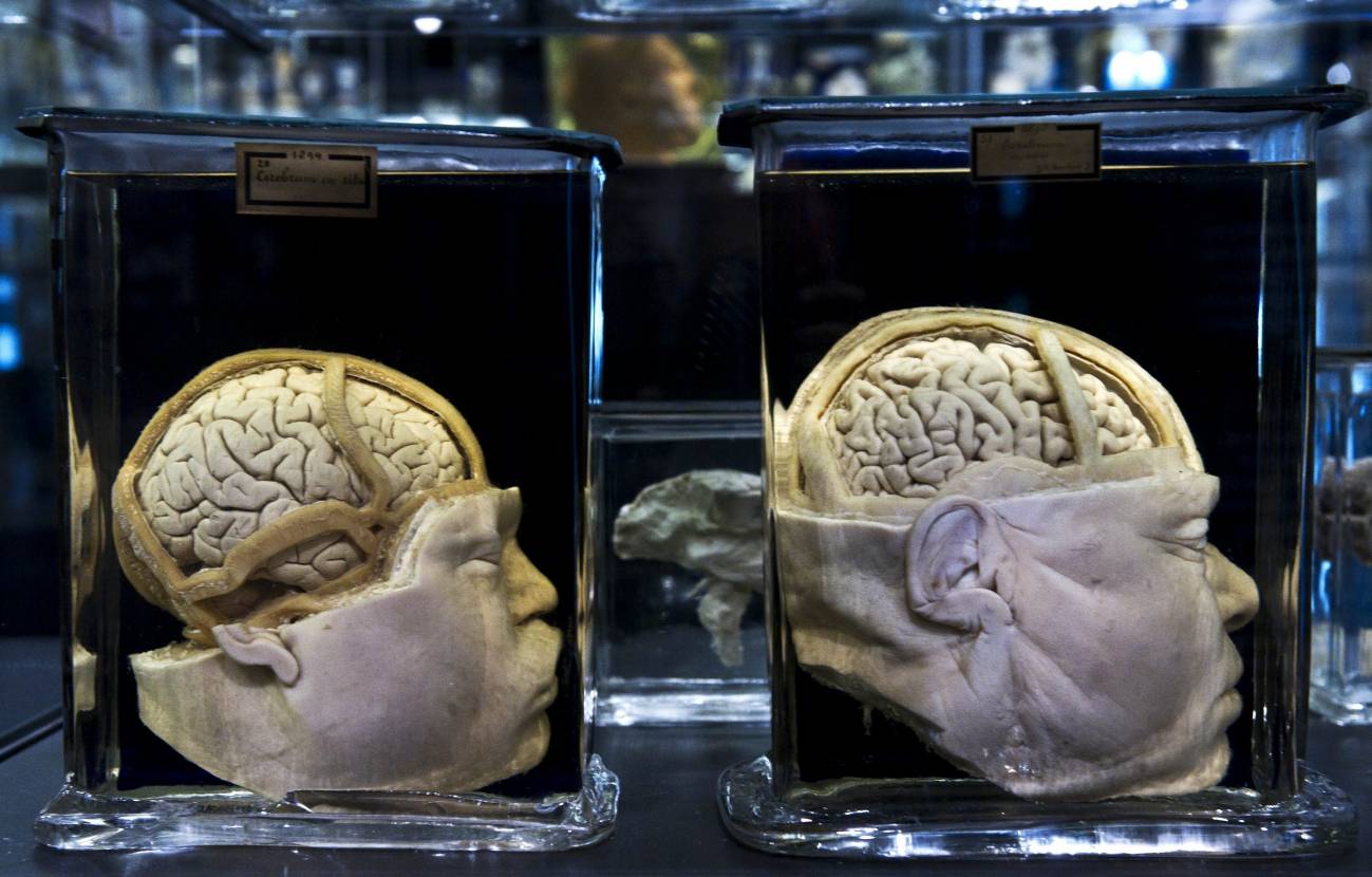 En la imagen, dos cabezas preservadas en el recientemente renovado Museo Vrolik, ubicado en el Centro Médico Académico de Amsterdam / Efe