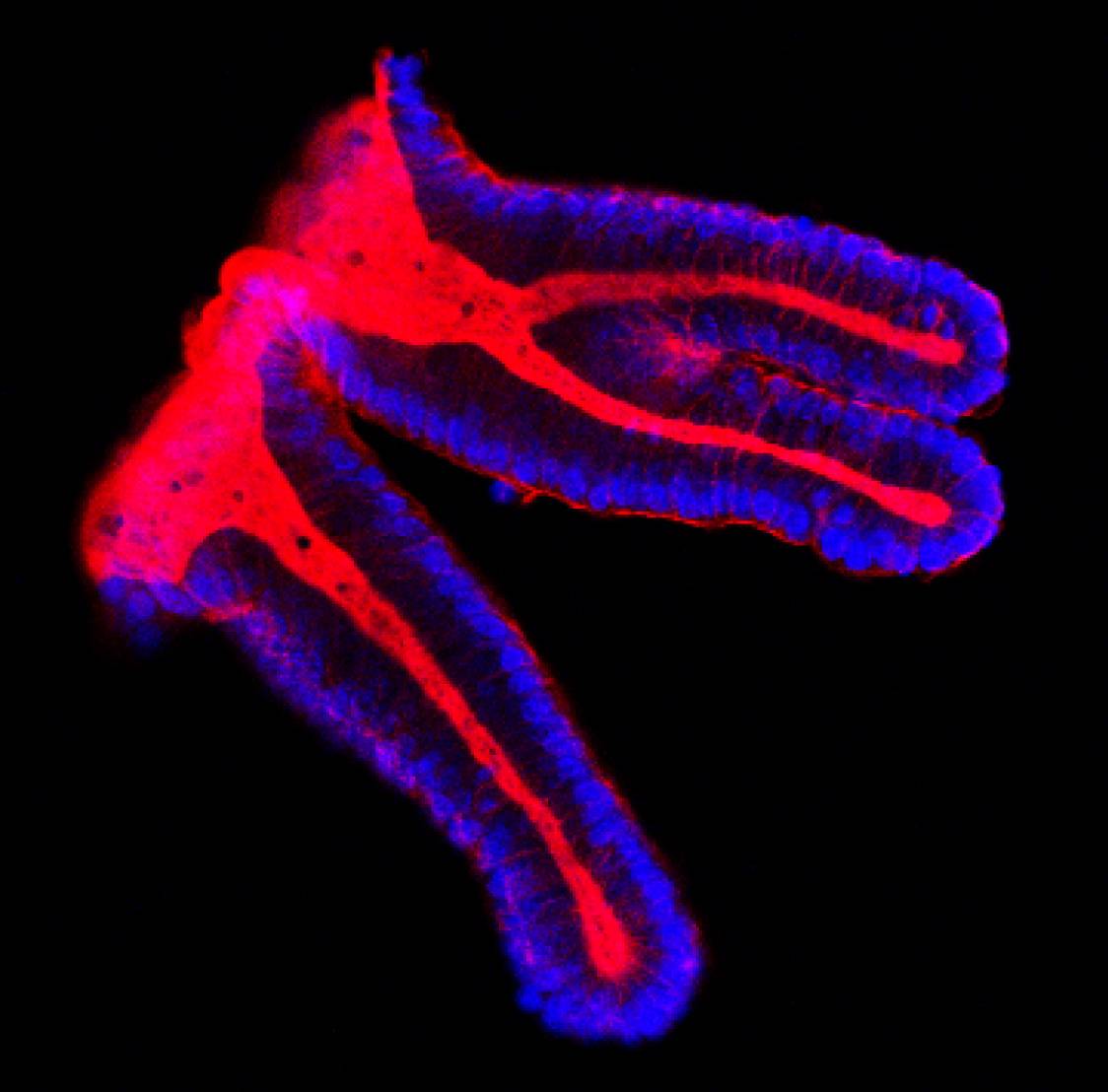 Células epiteliales de colon. Imagen: IRB 