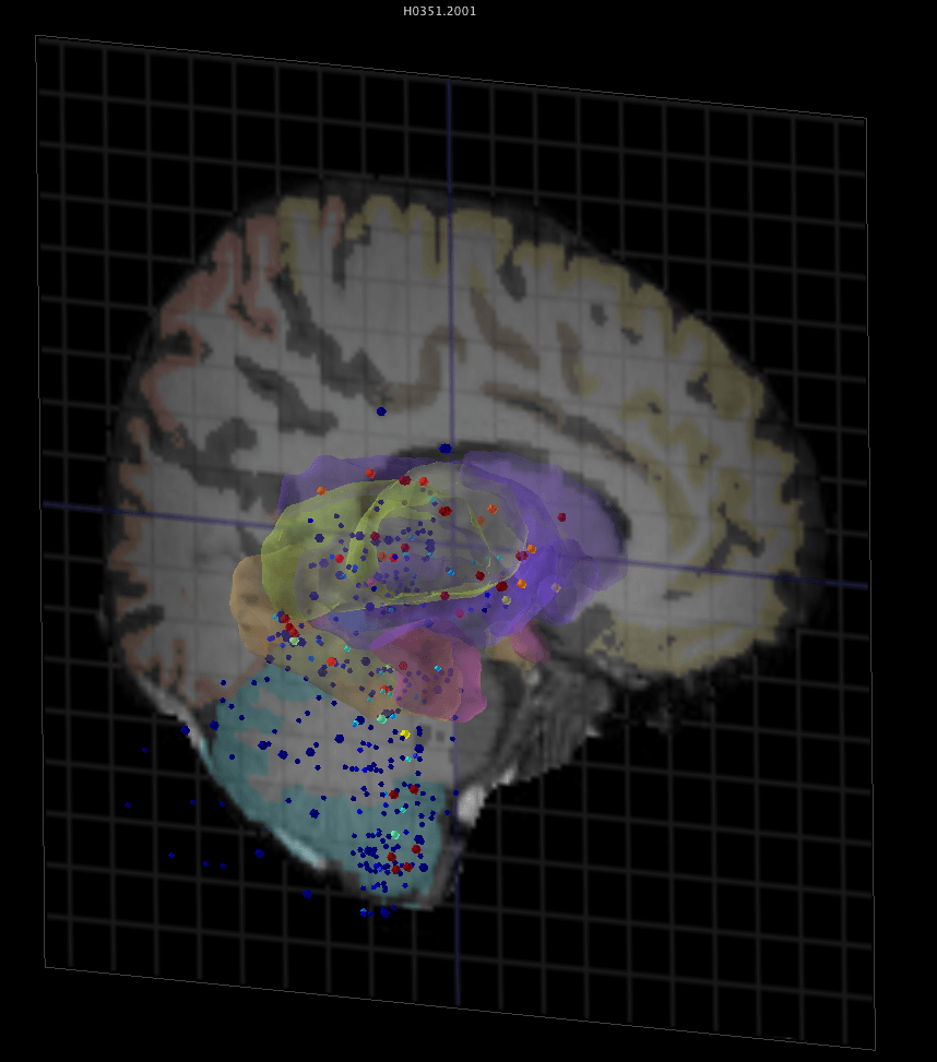  Representación en 3-D del cerebro humano que muestra la expresión de un único gen en las estructuras internas del órgano. Imagen: Allen Institute for Brain Science 