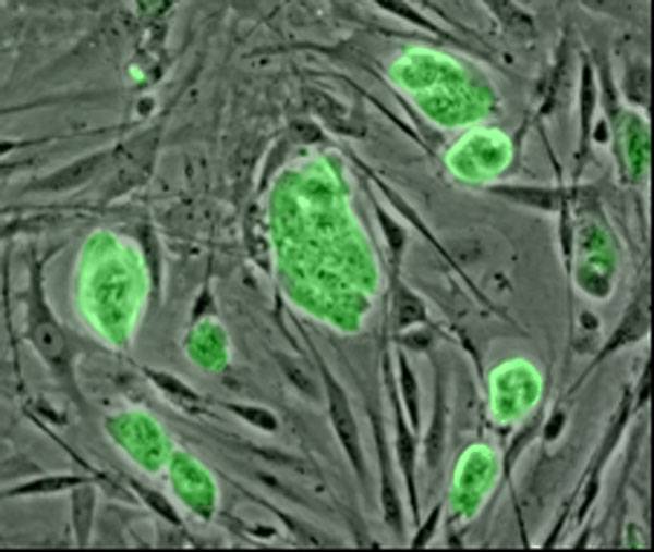Células madre de ratón, teñidas de verde. Imagen: Wikipedia