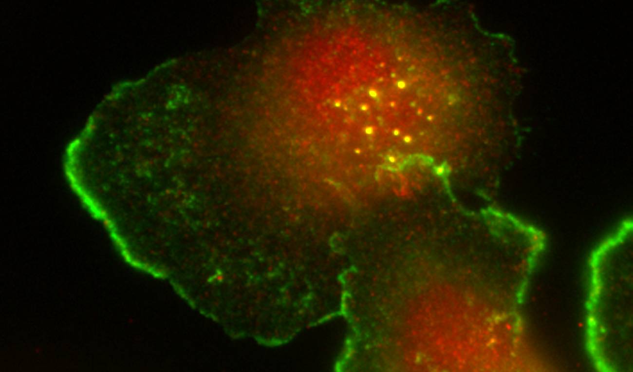 Células tumorales humanas de cáncer de mama teñidas para dos marcadores de invadopodio (cortactina en verde y Tks5 en rojo). Los invadopodia son las estructuras punteadas en el centro de la célula en color amarillo (debido a la presencia de las dos proteínas, cortactina y Tks5, en los invadopodia). / Valenzuela-Iglesias et al.