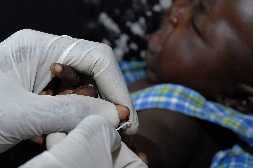 Vacunan contra malaria a una niña