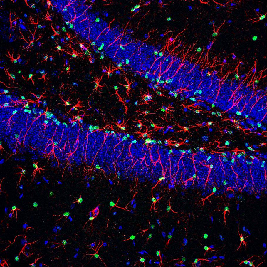 Células madre quiescentes del hipocampo adulto. Imagen: ISCIII 