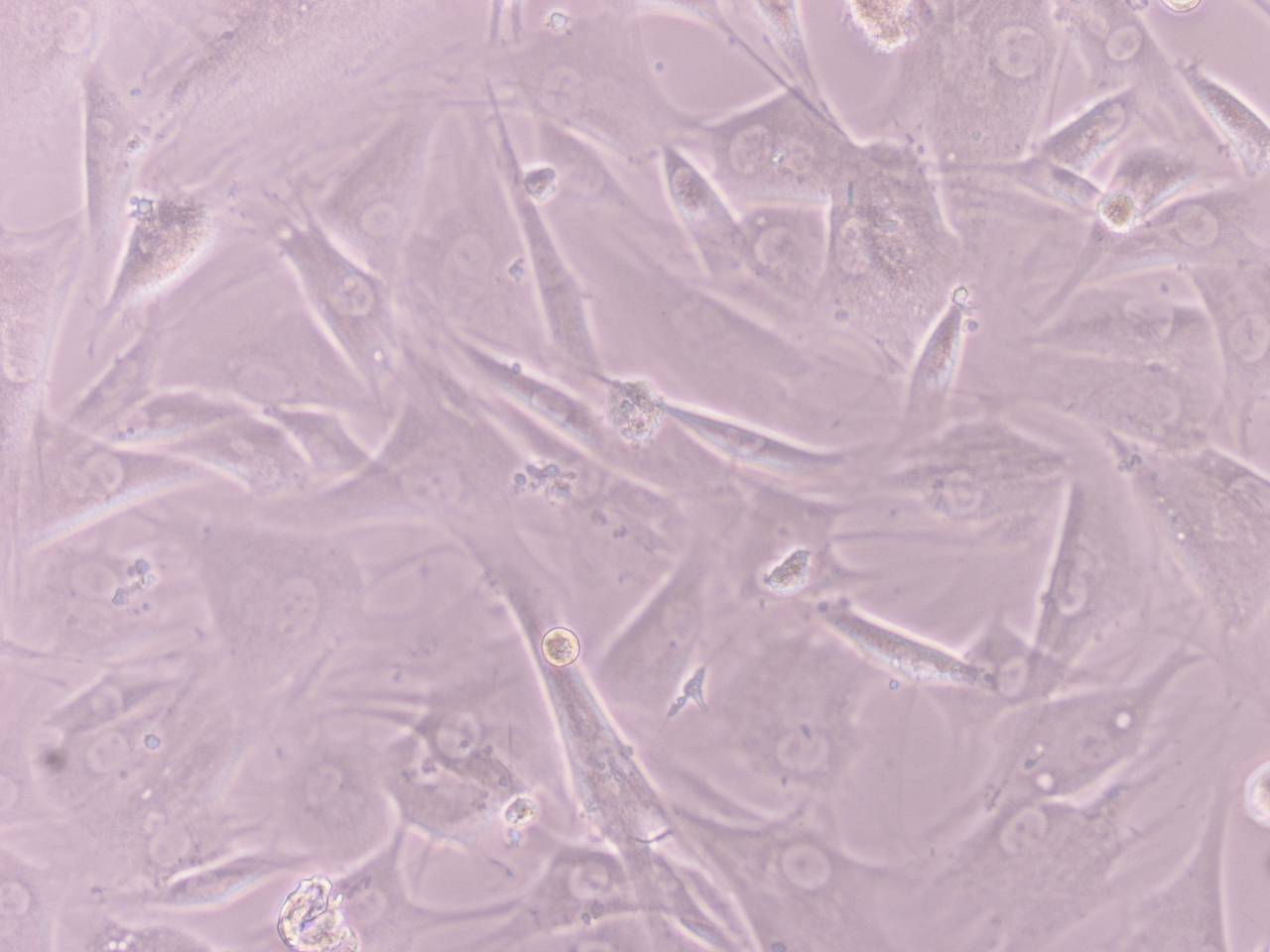 Suspenden el primer ensayo autorizado con células madres embrionariasensayo 