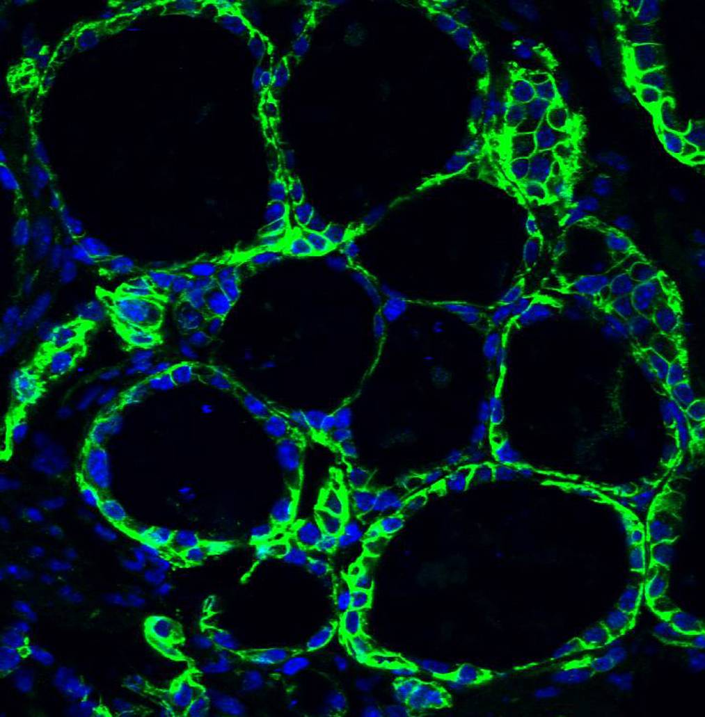 Tinción de yodo (verde) expresado por los folículos tiroideos obtenidos in vitro a partir de células madre embrionarias de ratón. Imagen: S. Costagliola 