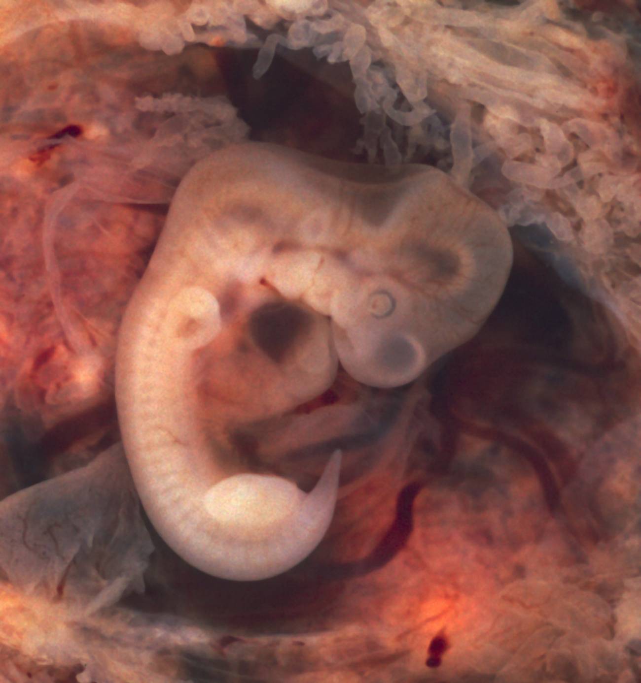 Embrión humano. Imagen por Euthman