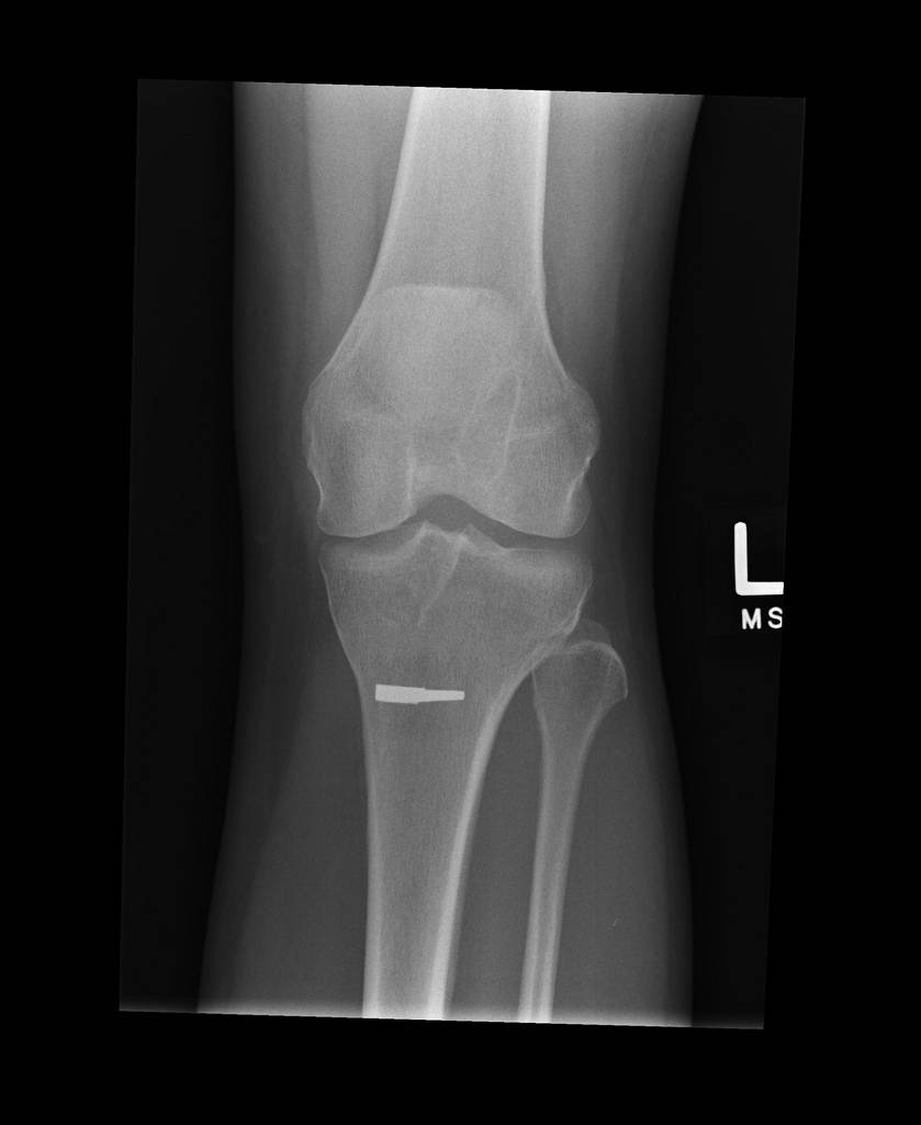Radiografía de rodilla. Imagen: kxcd