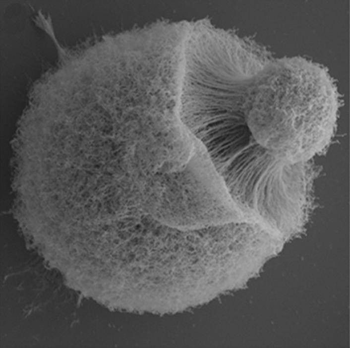 Un hongo ambiental aumenta hasta casi 1000 veces su tamaño para pervivir en el organismo