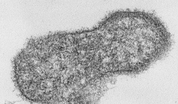 Célula infectada por virus de Nipah. Imagen: AAHL Biosecurity Microscopy Facility, Australian Animal Healt 