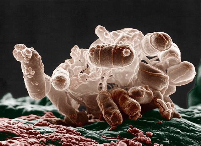 Escherichia coli al microscopio electrónico. Imagen: Microbeworld