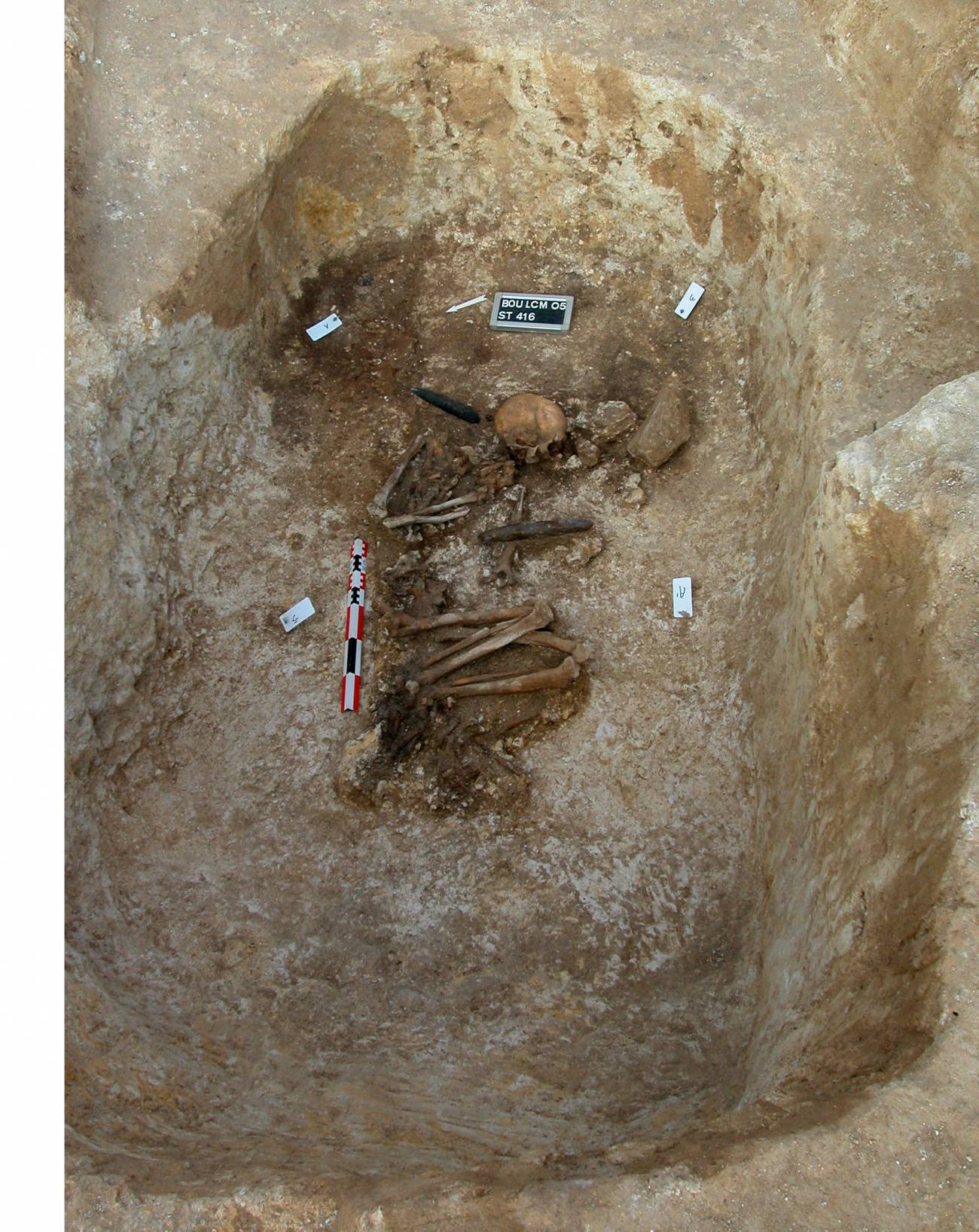Descubren evidencias de una operación quirúrgica de hace casi 7.000 años