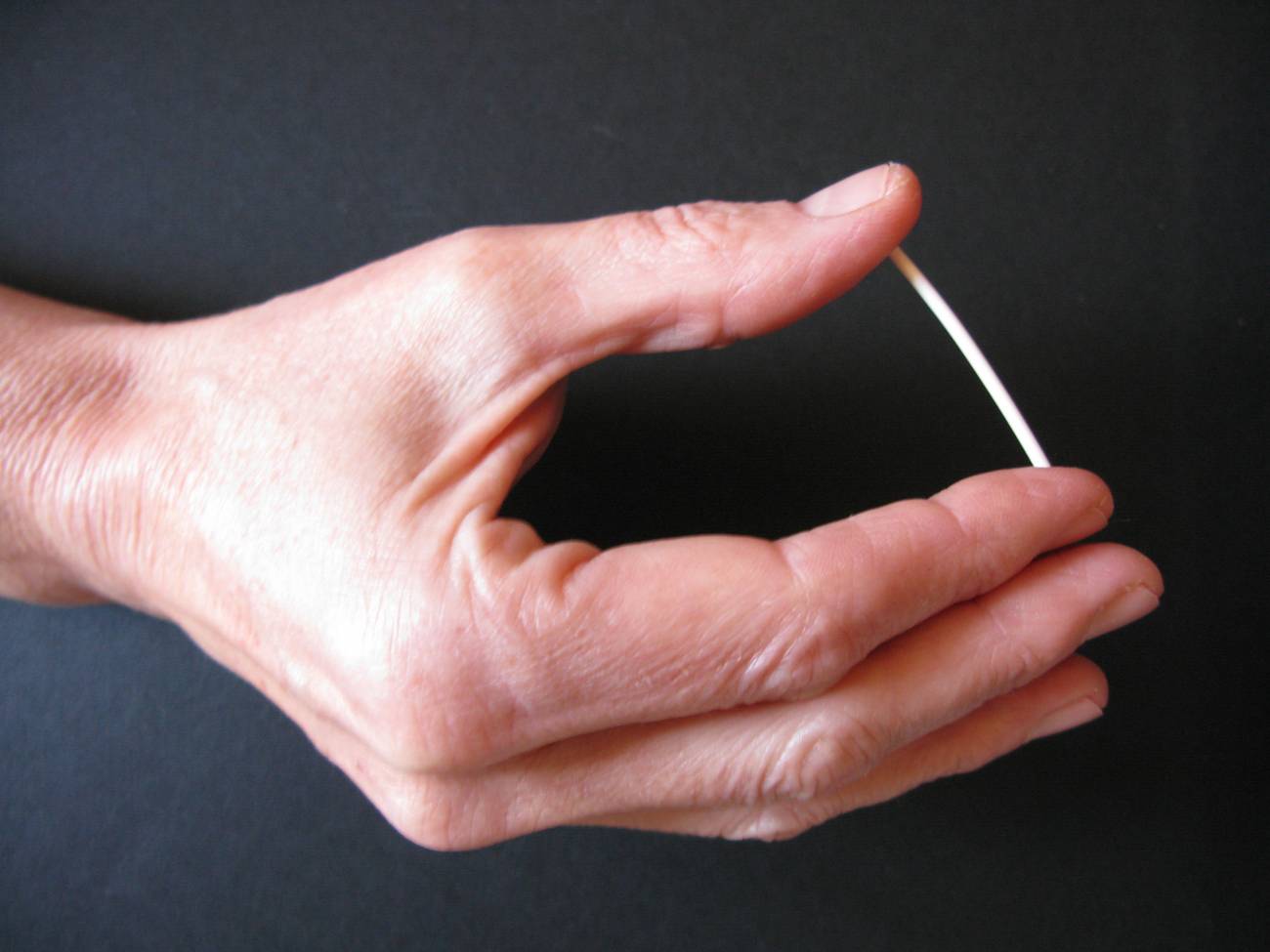 El implante subcutáneo de gestágeno es el método anticonceptivo más eficaz