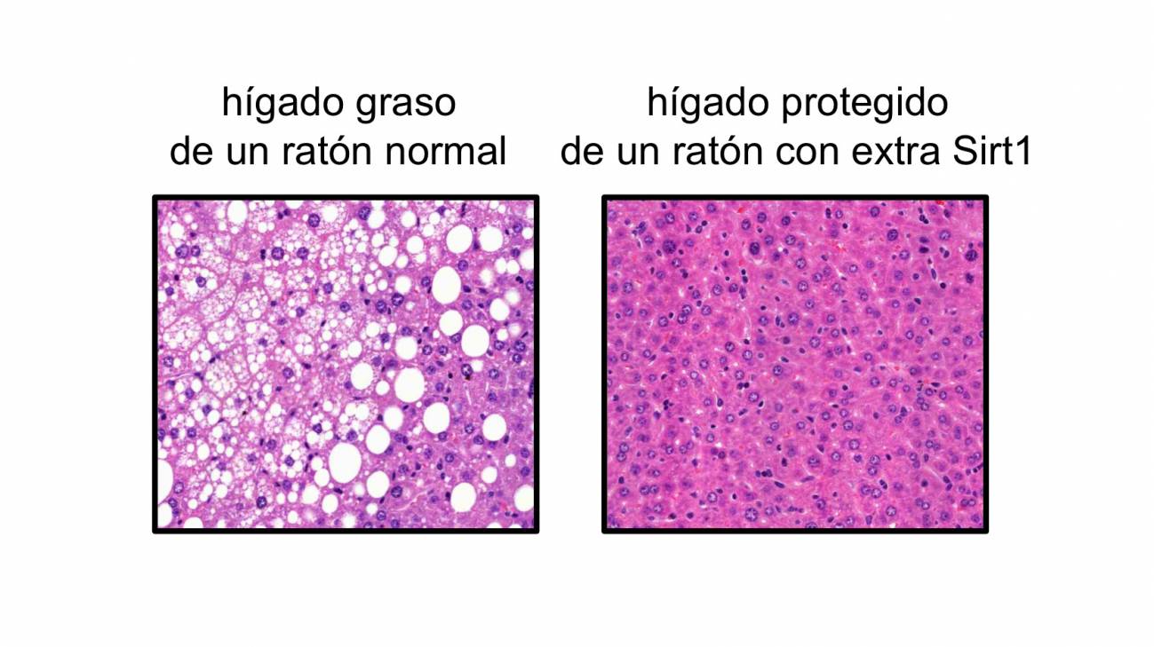 La proteína Sirt1 protege contra el cáncer de hígado en ratones