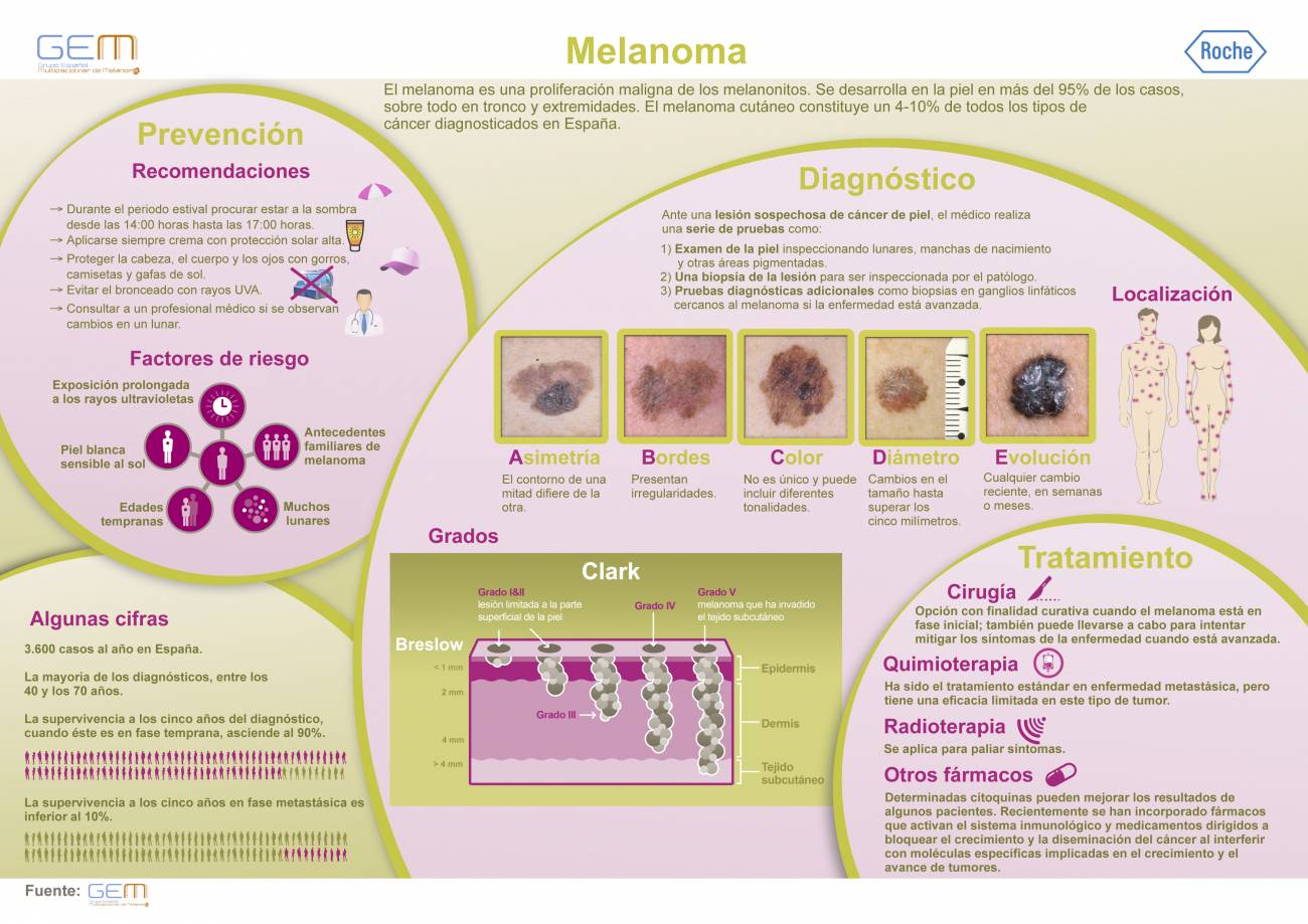 Infografía sobre prevención y tratamiento del melanoma. / CEM