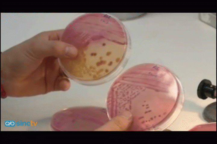 Continúa sin conocerse el foco de contaminación de la bacteria E.coli