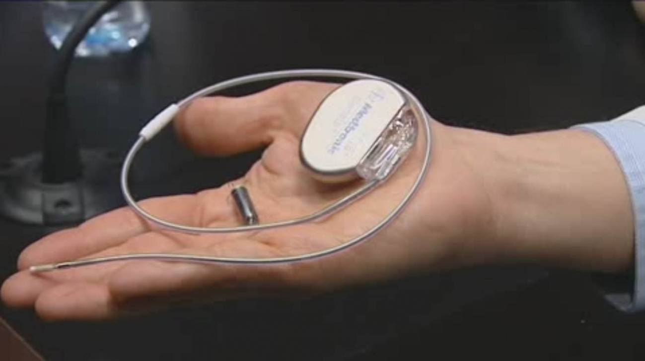 El Clínic implanta el marcapasos más pequeño del mundo