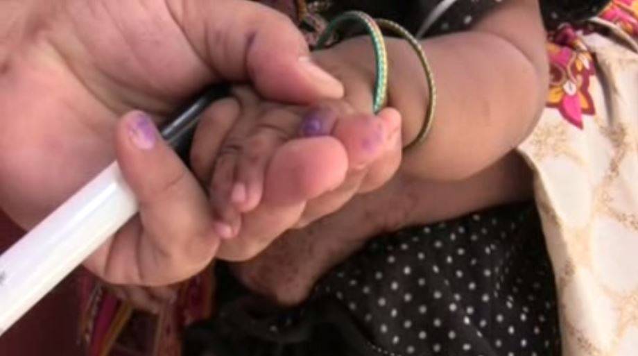 Pakistán instenta acabar con la polio definitivamente