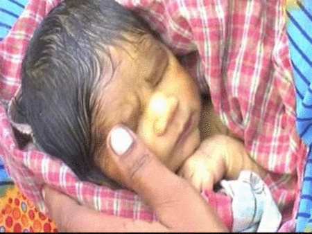 Treinta niños indios nacen ciegos o con extremidades amputadas 