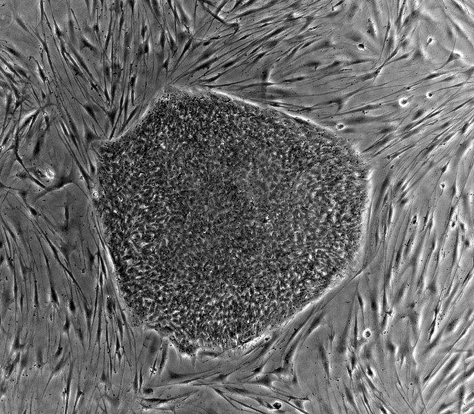 Células madre embrionarias humanas