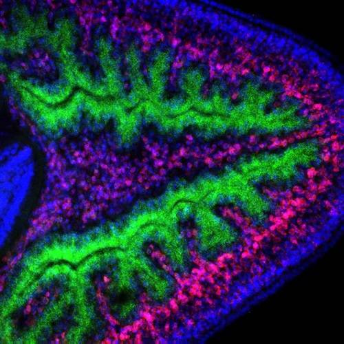Imagen de un marcaje donde se puede ver el sistema digestivo de la planaria (verde), los neoblastos (rosa) y los núcleos celulares (azul).