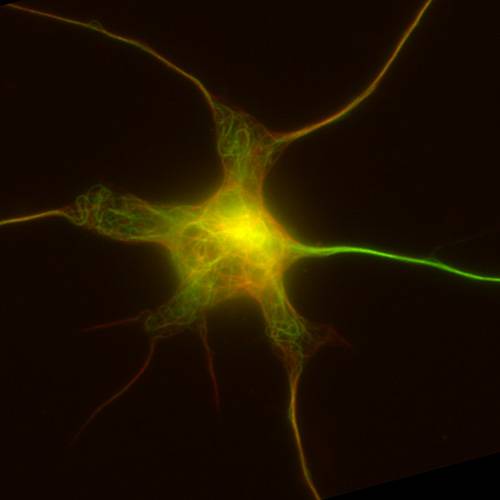 Micritúublos en una neurona de ratón