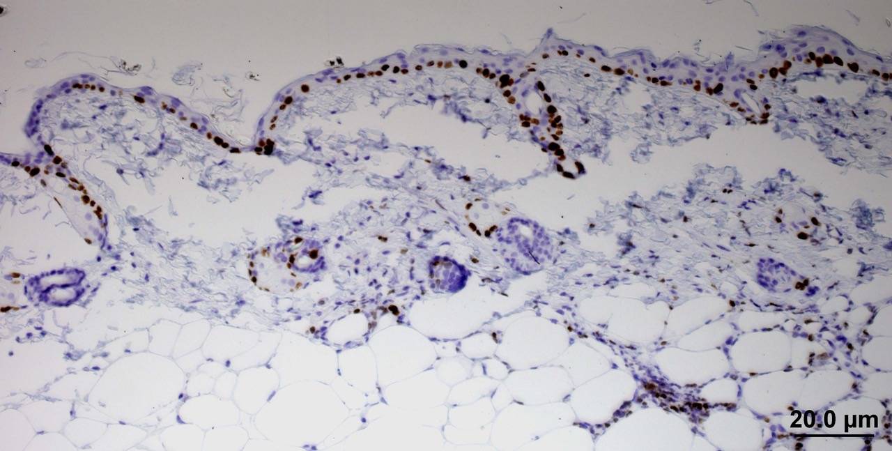 resistencia a la quimioterapia en células epiteliales de ratón
