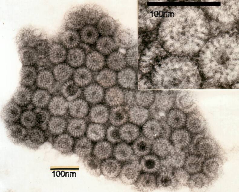 Imagen del rotavirus