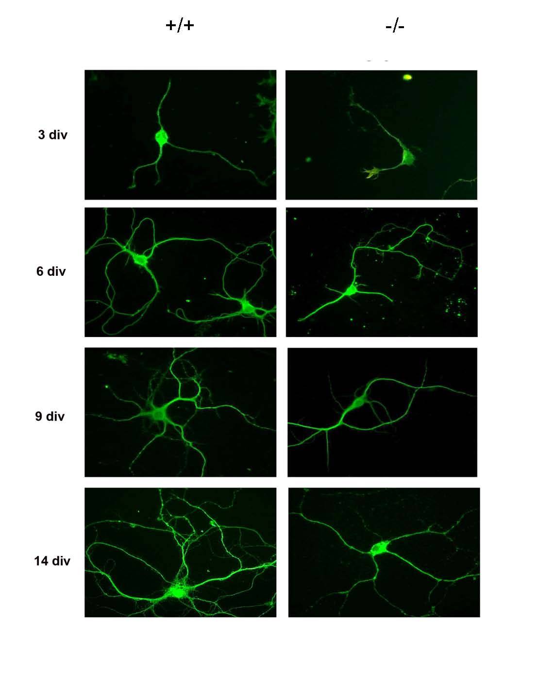 neuronas del hipocampo de un ratón que no expresa la proteína RhoE