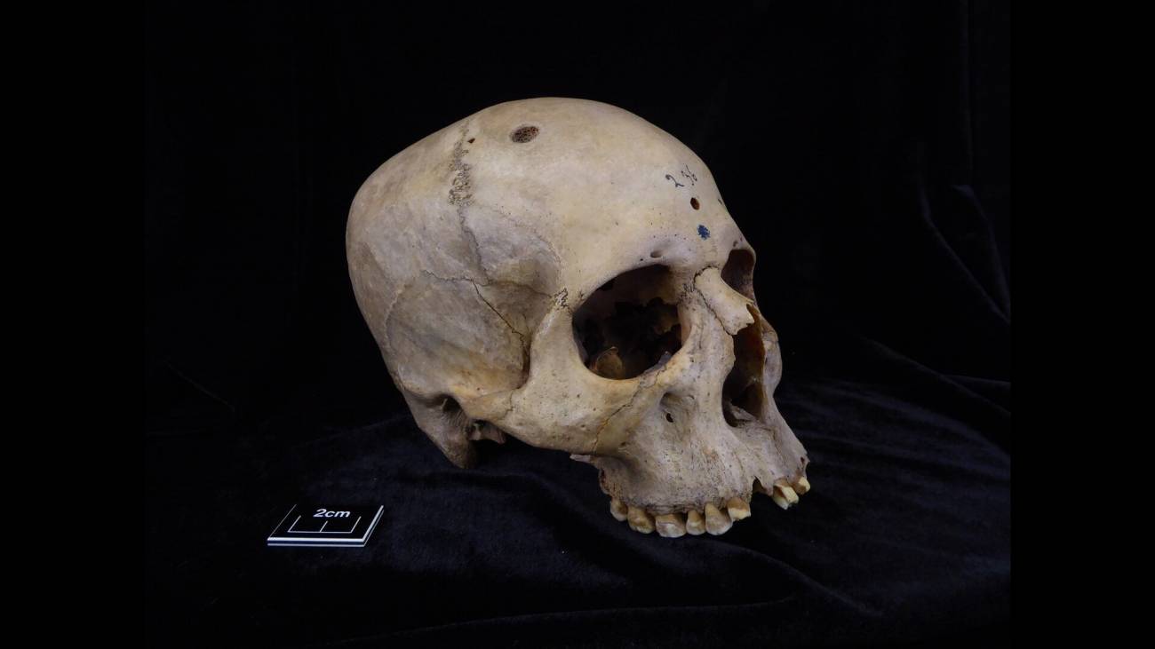 Descubren posibles intentos de tratar el cáncer en un cráneo egipcio de 4.000 años