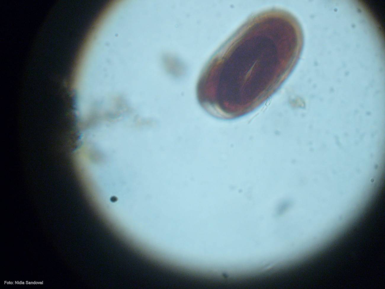 Tipo de helmintos procedente de las muestras recogidas en Panamá visto al microscopio.