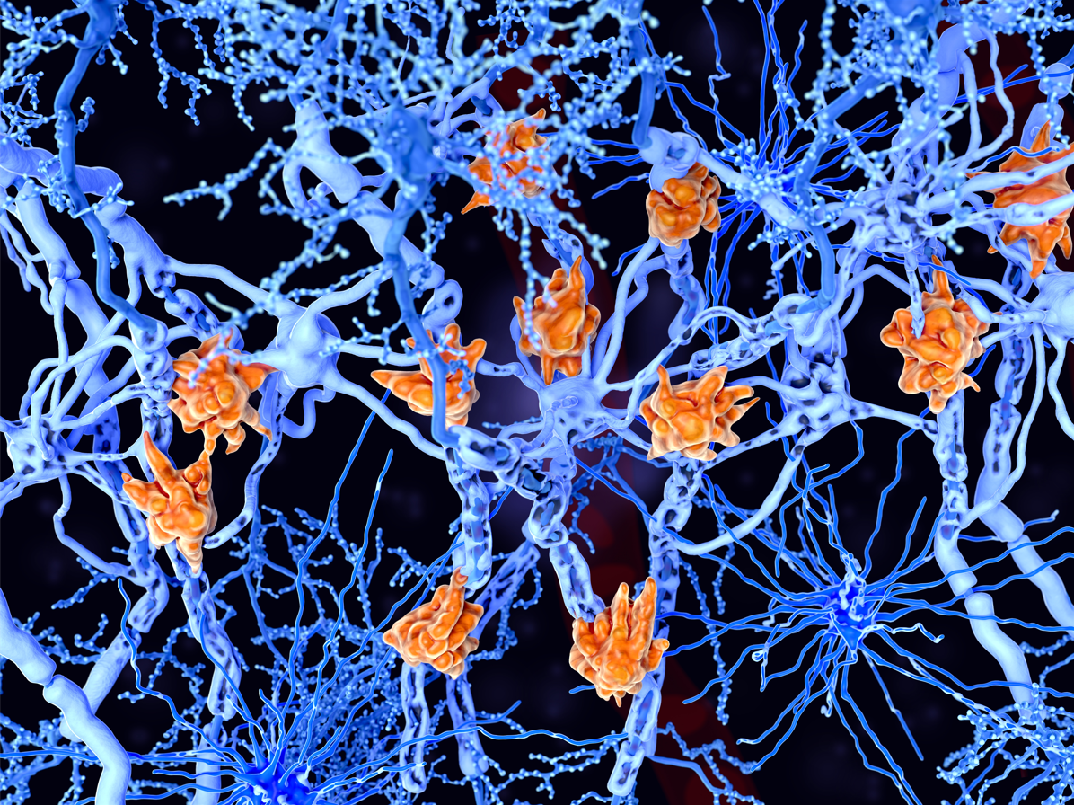Las células de la microglía dañan la vaina de mielina de los axones de las neuronas