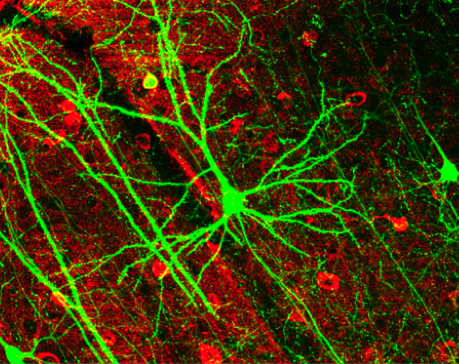 Red  de neuronas. Imagen: Wikipedia  