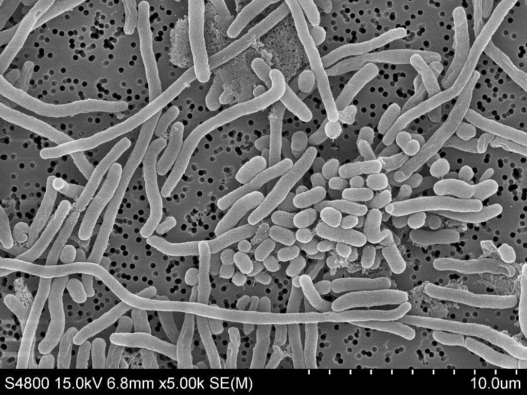 Imagen microscópica de la bacteria Acinetobacter baumannii.