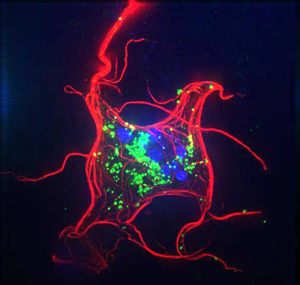 En rojo, el “ataúd” formado por microtúbulos para proteger la membrana celular