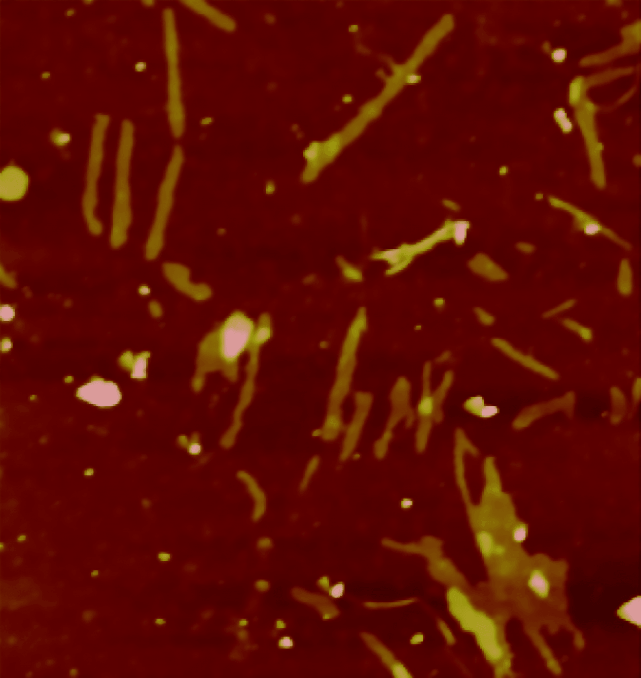 Agregados de la proteína Receptor de Andrógenos (en la imagen) dañana las células musculares y neuronas motoras en la enfermedad de Kennedy 