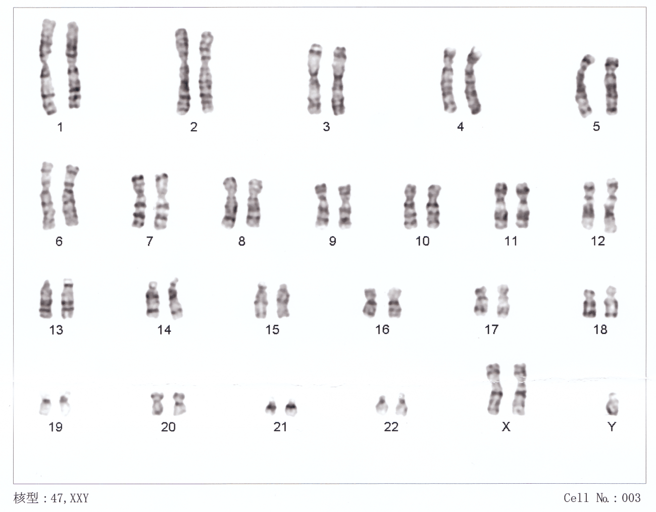 imagen de cromosomas humanos
