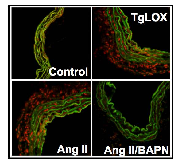 Las arterias de ratones que sobre-expresan lisil oxidasa (TgLOX) muestran mayores niveles de estrés oxidativo (tinción roja) que los animales control. El aumento del estrés oxidativo observado en un modelo de hipertensión arterial por infusión de Angiotensina II, se reduce drásticamente en presencia de un inhibidor farmacológico de la lisil oxidasa (BAPN). /UAM-ICCC-CSIC