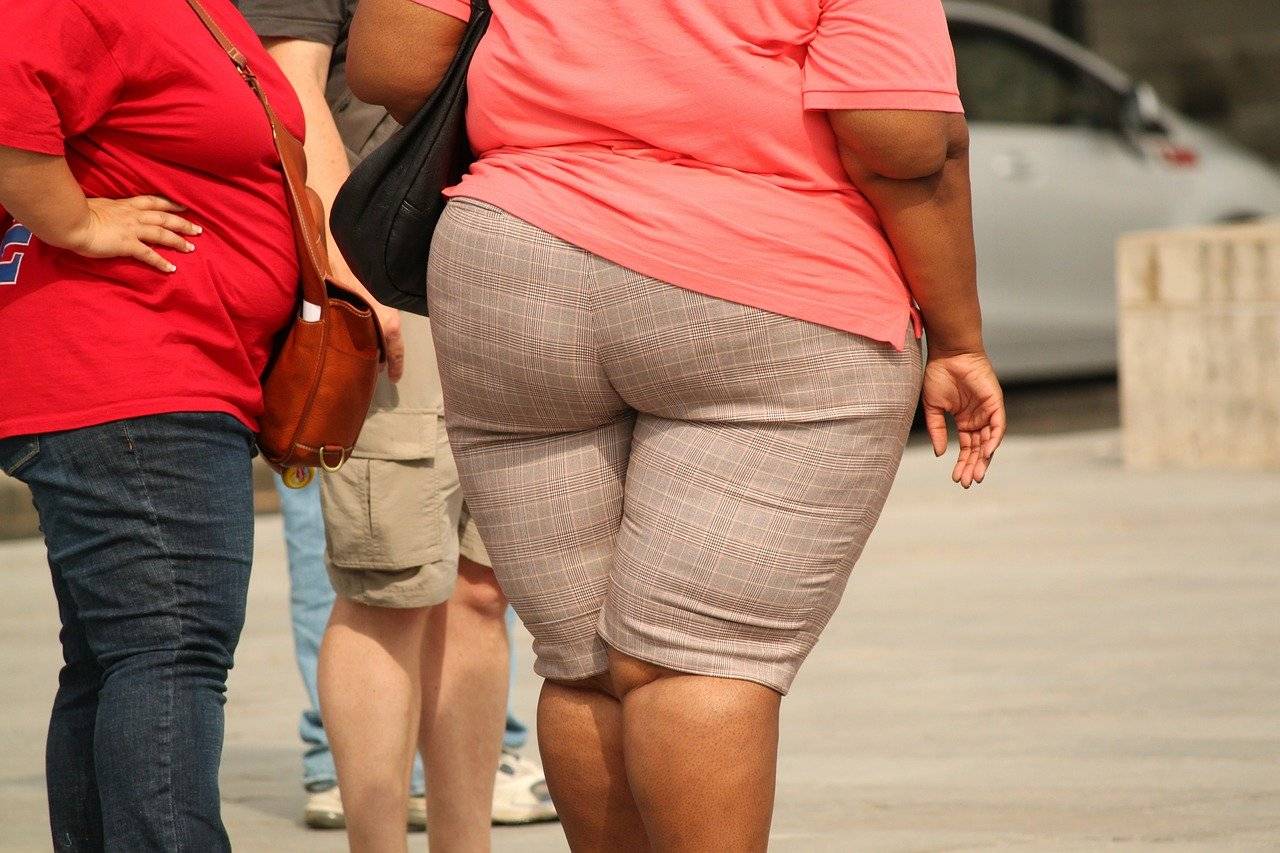 obesidad mórbida