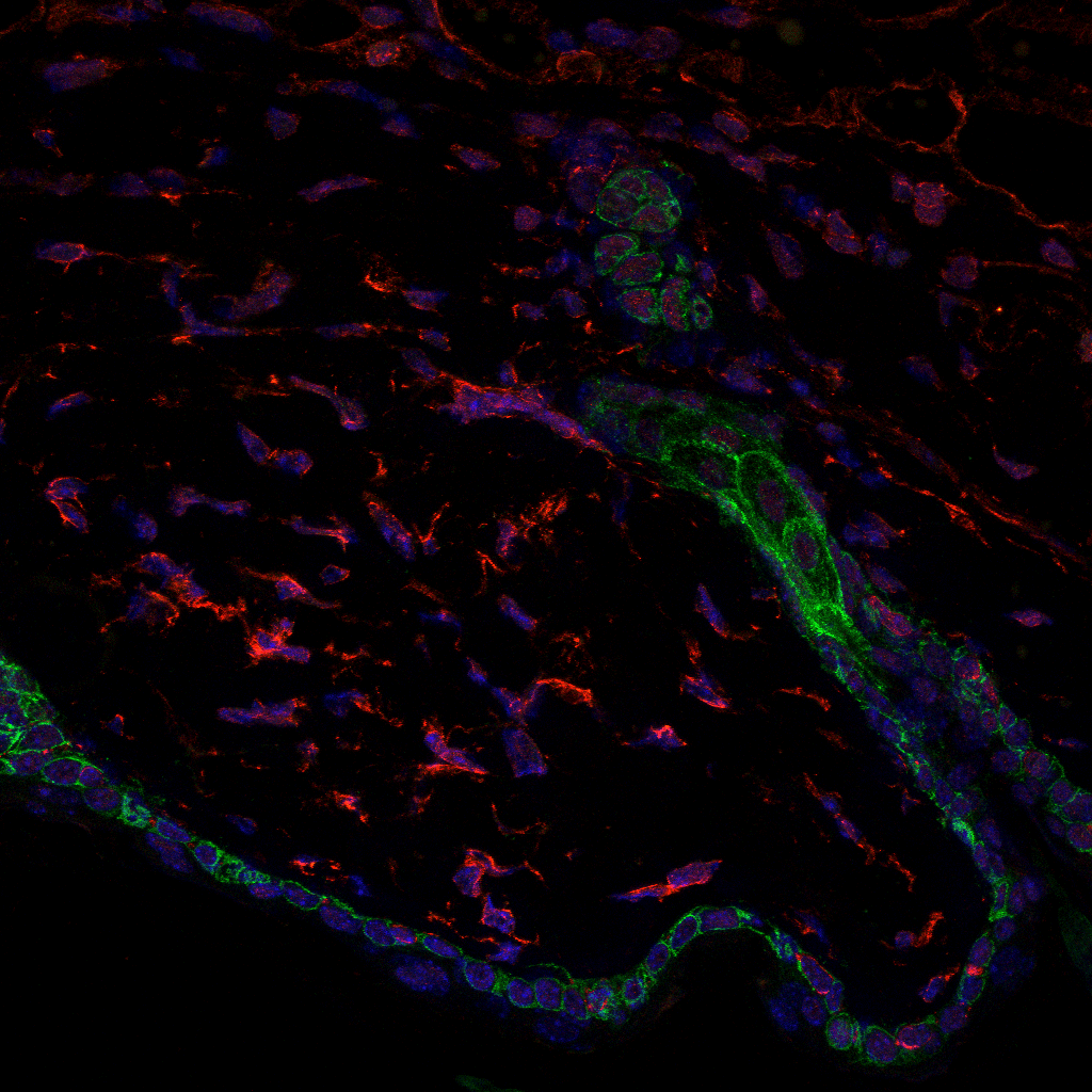 barrera de la piel (en verde), folículo piloso (en verde) y los fibroblastos (en rojo)