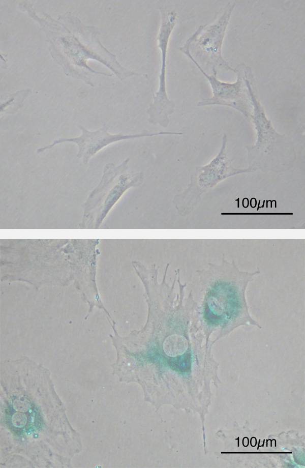 Fibroblastos embrionarios primarios  de ratón antes (arriba) y después de la senescencia (abajo). / Wikipedia