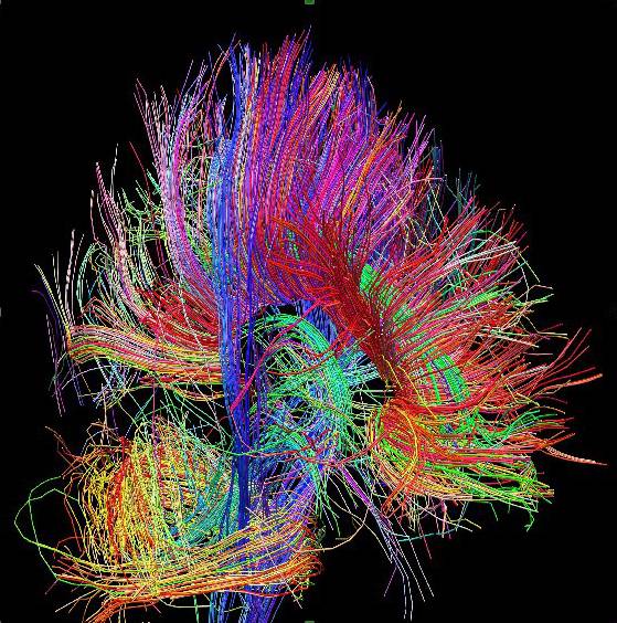 Arquitectura de las fibras de materia blanca, que informa acerca de la relación entre regiones cerebrales, cortesía del proyecto Human Connectome.