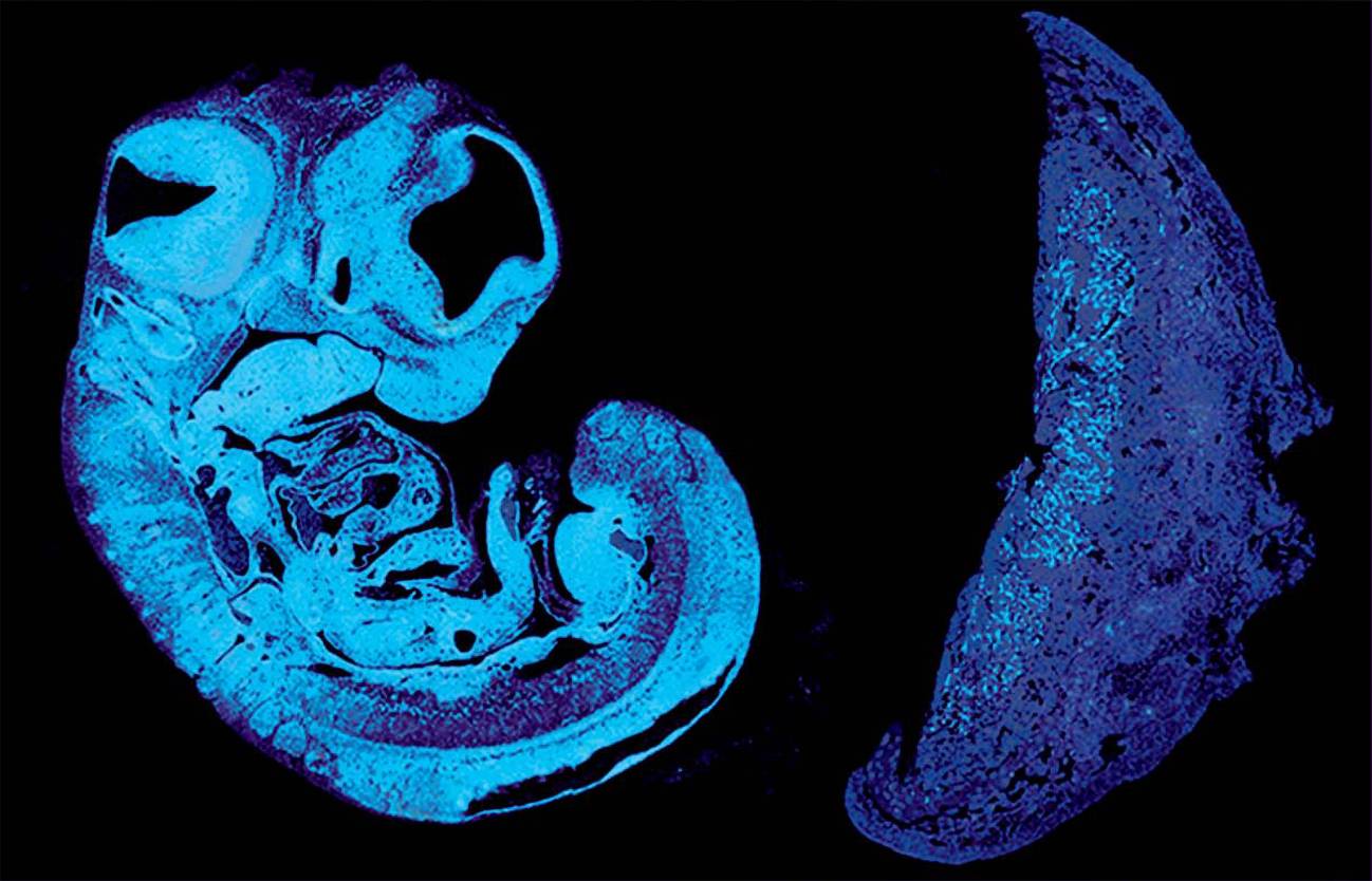 Sección de un feto de ratón y la placenta