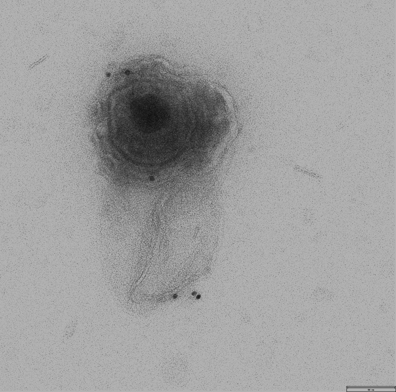 microvesícula conteniendo un virión